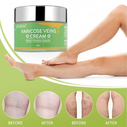 Vein Relief Cream